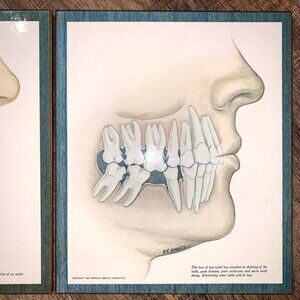 2 Lot MCM 1966 Dentist Office American Dental Association W R Schwartz TEETH ART